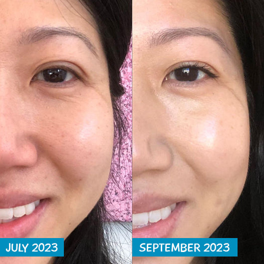 Amplified Anti-Aging Peptide Active Serum with Argireline® 25ml