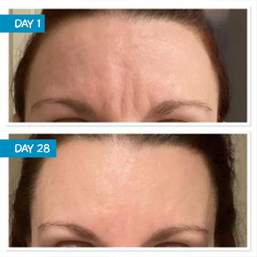 Amplified Anti-Aging Peptide Active Serum with Argireline® 25ml